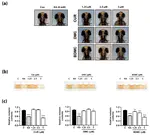 Antimelanogenic effects of curcumin and its dimethoxy derivatives: Mechanistic investigation using B16F10 melanoma cells and zebrafish (Danio rerio) embryos